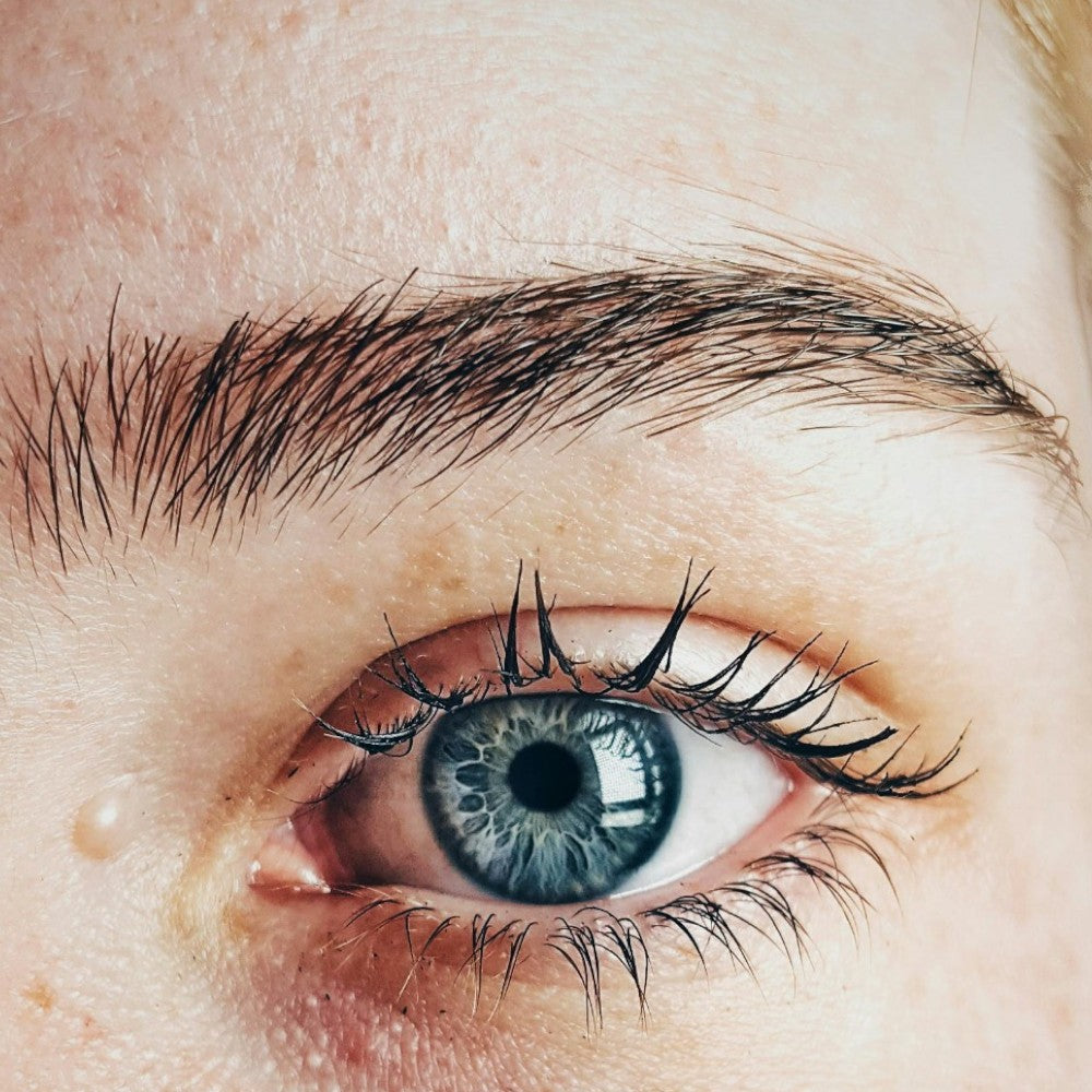 Trockene Haut im Gesicht – was wirklich hilft (und was nicht)