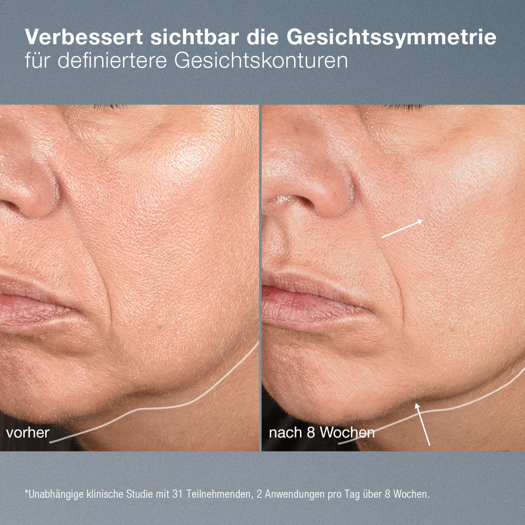 DERMACOLOR NeuroTouch Symmetry Serum – 30ml, Vorher-Nachher Bild