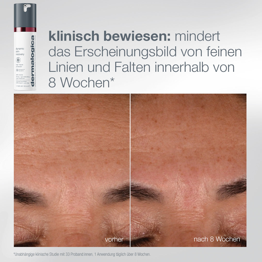 DERMALOGICA Expert Protect + Renew - Dynamic Skin Recovery Set, -, Dynamic Skin Recovery Cream vorher-nachher
