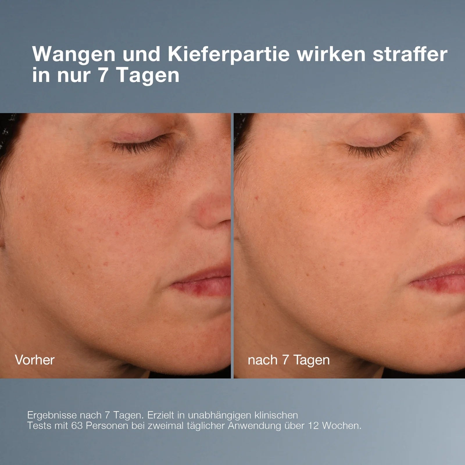 DERMALOGICA Pro-Collagen Banking Serum – Kollagenpflege, 30ml, Klinische Studie Vorher-Nachher Vergleich