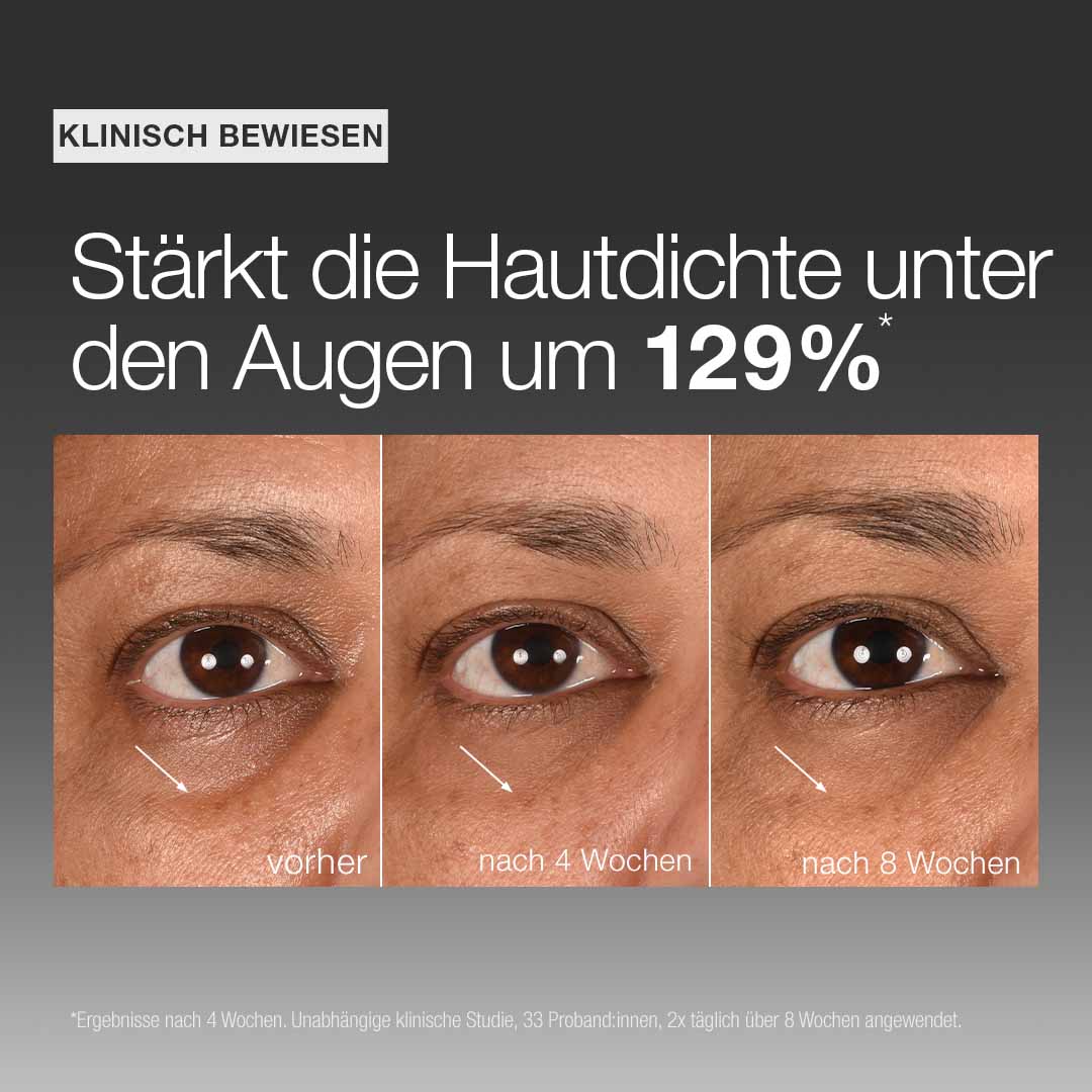 DERMALOGICA Smart Eye Density Serum – gegen eingefallene Augenpartien, 15ml, Ergebnisse Wirksamkeitsstudie
