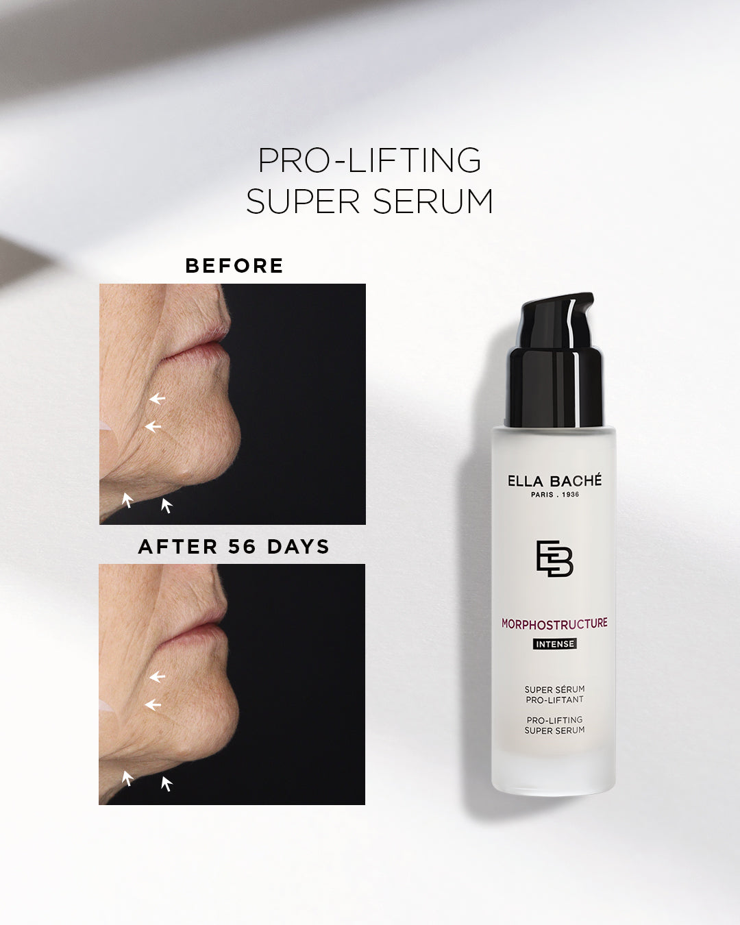 ELLA BACHE MORPHOSTRUCTURE - Pro-Lifting Powerserum, 30ml, vorher-nachher Vergleich nach 56 Tagen Anwendung
