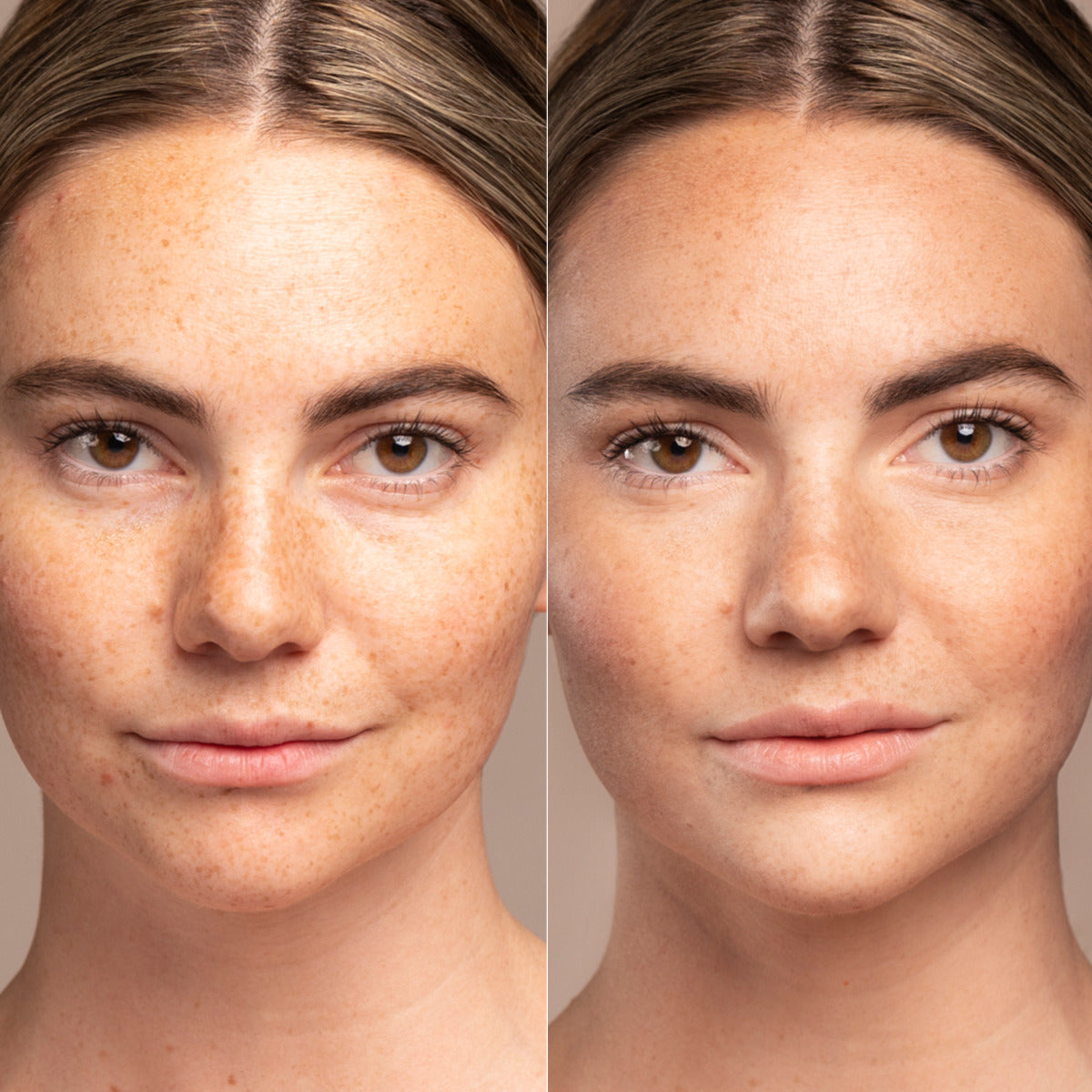 IMAGE SKINCARE Prevention+ sun serum SPF 30 – Leichtes Sonnenschutzserum, 28,3g, Gesicht Frau vorher-nachher Vergleich