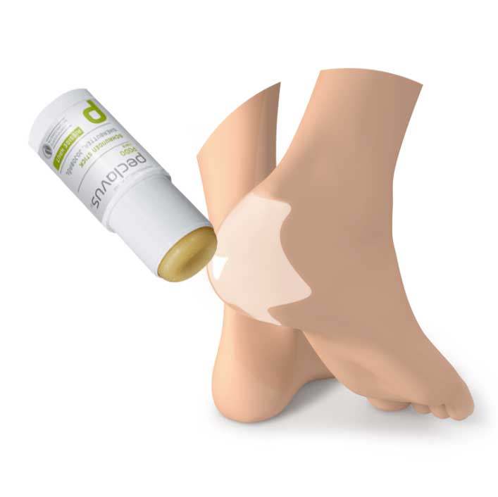 PECLAVUS Schrunden Stick – 23g, Anwendung des Sticks an Ferse