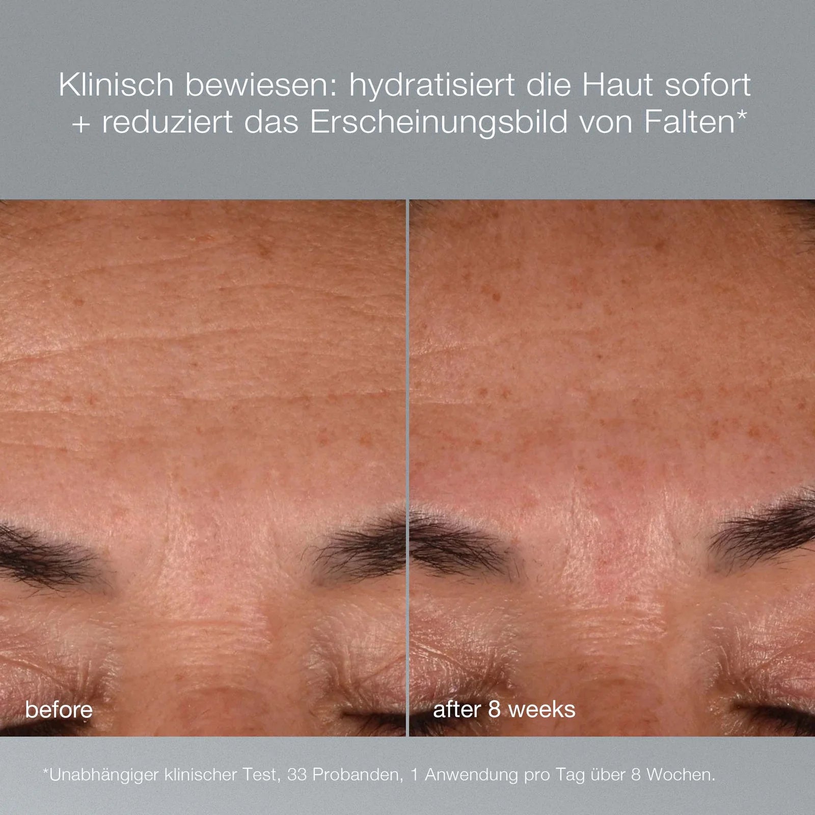 TOOFRUIT AGE smart Dynamic Skin Recovery SPF50 – AGE smart Dynamic Skin Recovery SPF50, 50ml, Klinische Studie vorher-nachher
