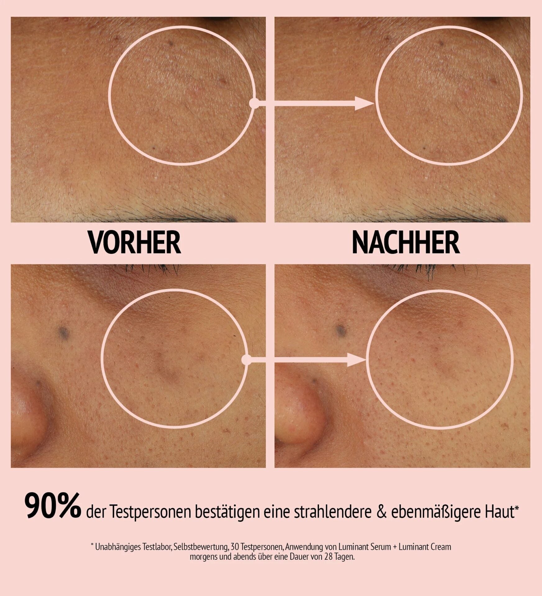 COMFORT ZONE Luminant Cream – hilft, dunkle Flecken gezielt zu bekämpfen, ihre sichtbare Ausprägung zu reduzieren und dem Teint mehr Strahlkraft zu verleihen., 10ml, vorher-nachher