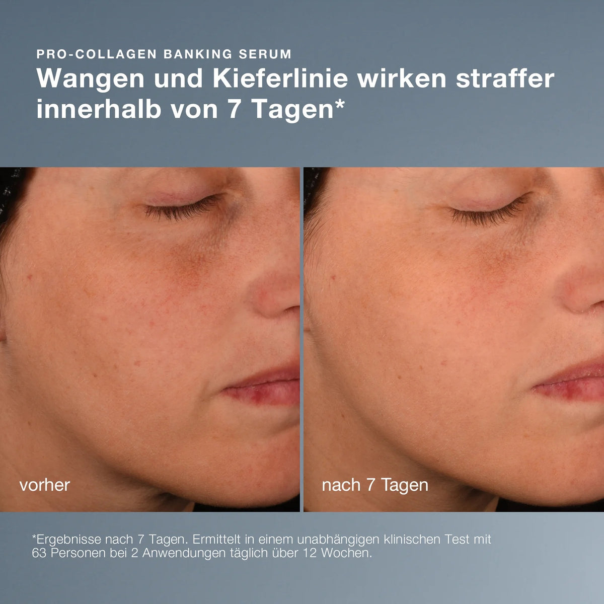 DERMALOGICA Hydration You Can Feel – Feuchtigkeits-Duo, -, Pro-Collagen Banking Serum vorher-nachher