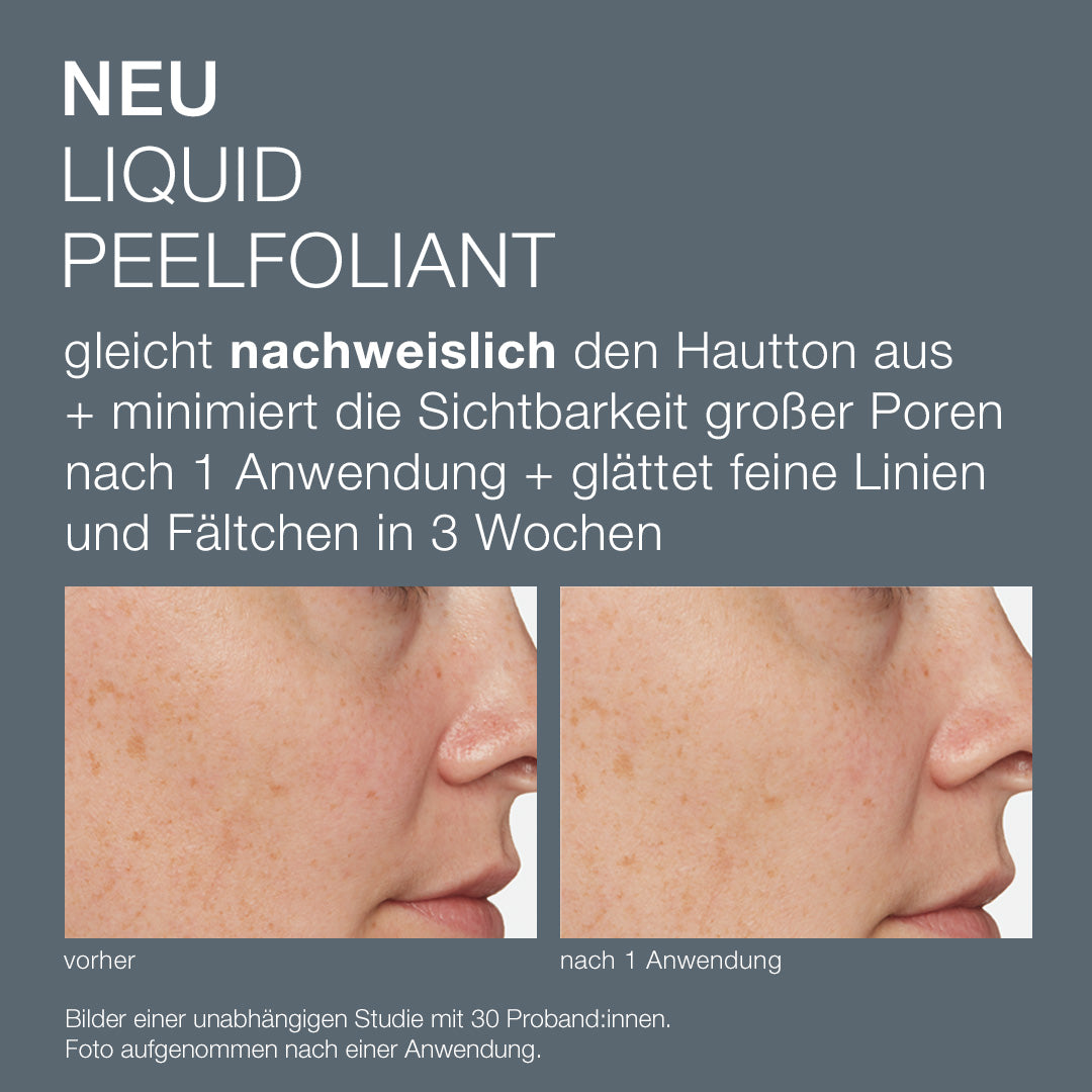 DERMALOGICA Liquid Peelfoliant – reduziert das Erscheinungsbild feiner Linien sowie Fältchen und verkleinert die Poren sichtbar nach nur einer Anwendung., 59ml, vorher-nachher