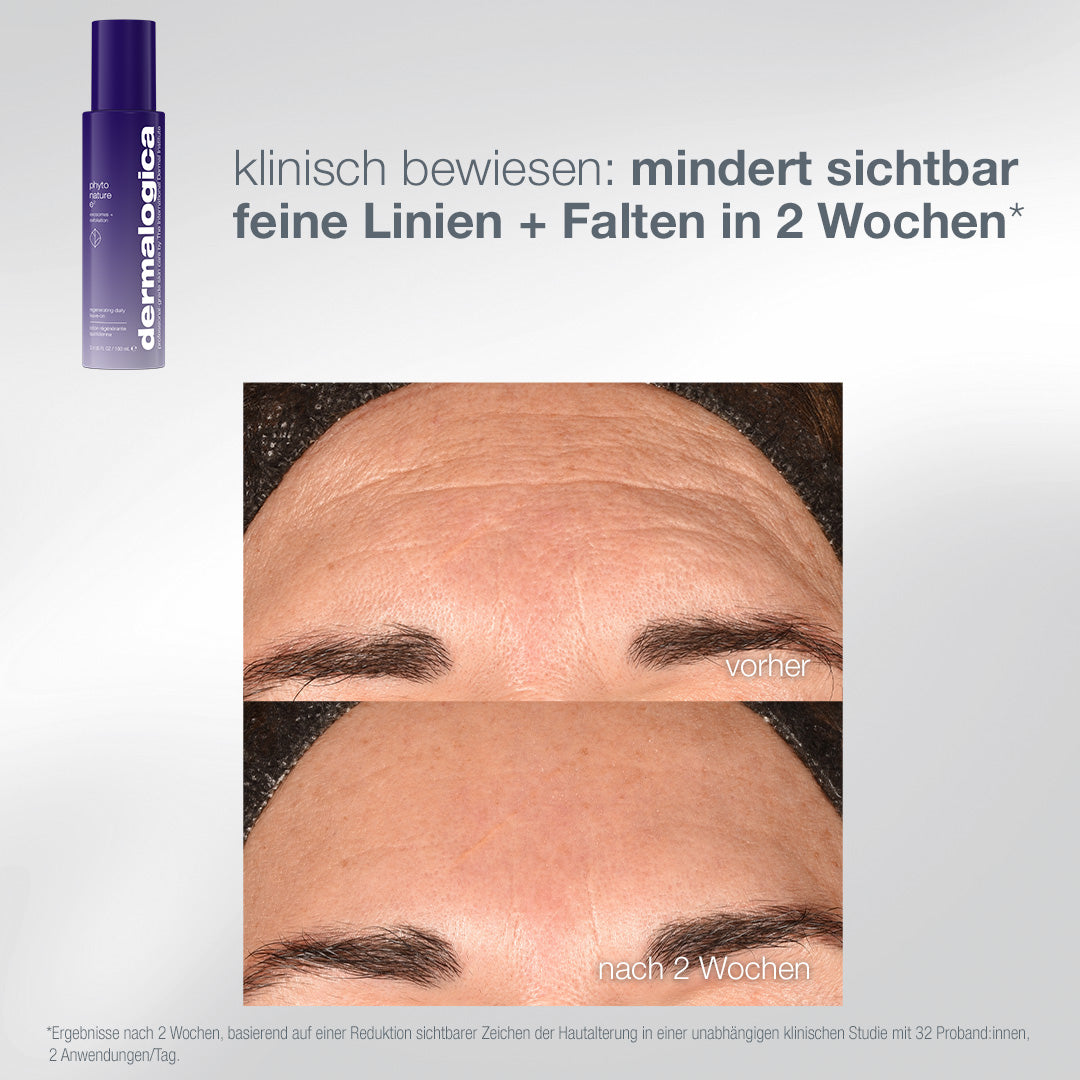 DERMALOGICA The Expert Lift Set – 3 Phyto Nature Originalgrößen, -, Phyto Nature E2 Vorher-Nachher