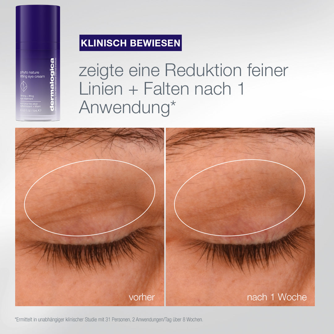 DERMALOGICA The Expert Lift Set – 3 Phyto Nature Originalgrößen, -, Phyto Nature Eyecream vorher-nachher