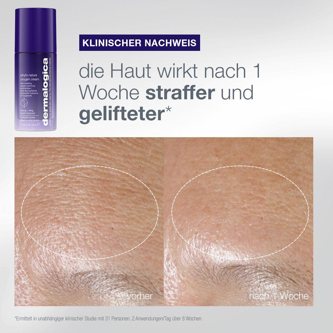 DERMALOGICA The Expert Lift Set – 3 Phyto Nature Originalgrößen, -, Phyto Oxygen Cream vorher nachher