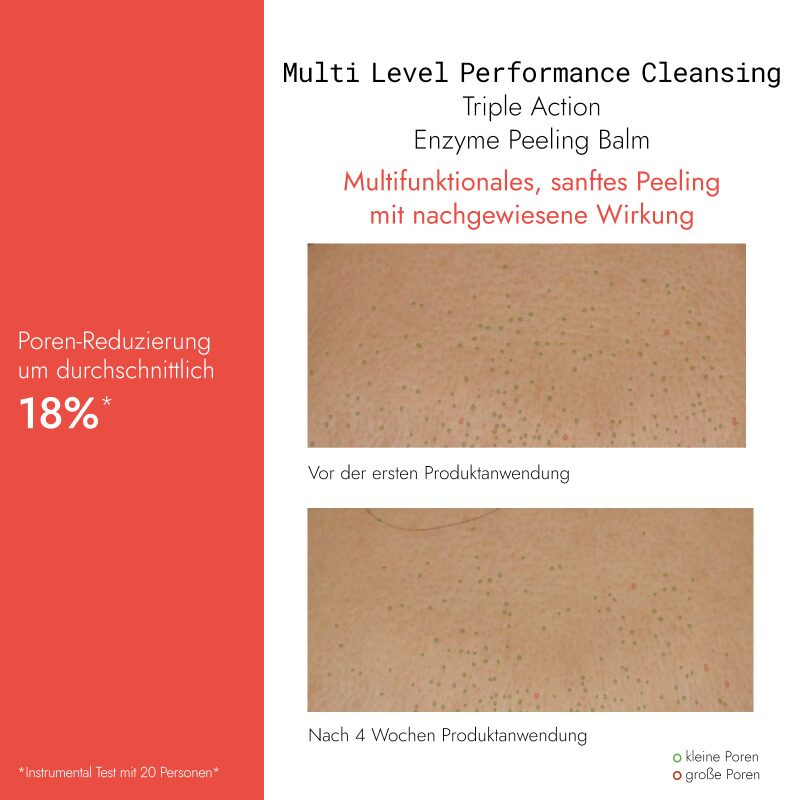 KLAPP Triple Action Enzym Peeling Balm – Sanftes Enzym-Peeling, 50ml, Vorher-Nachher Vergleich Porengröße nach 4 Wochen Anwendung