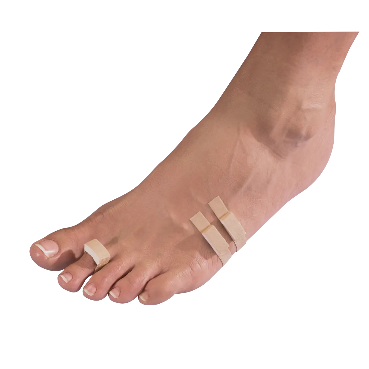 PEDIBAEHR Druckschutzpflaster mit Schaumstoffeinlage, 1 Pack (4 Stk.), Anwendungsbeispiele Fuß
